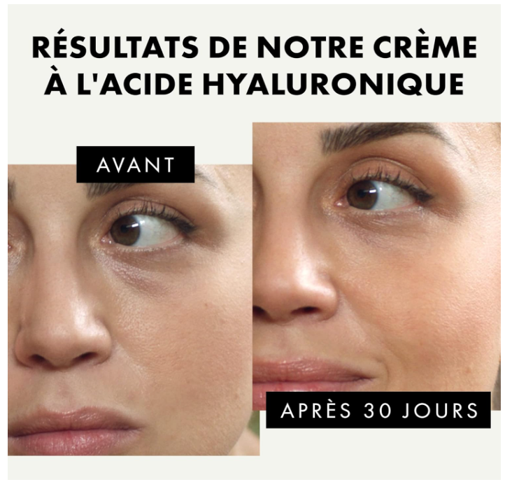 Crème à l'acide hyaluronique biologique - 3X PLUS EFFICACE avec 2% d'AH - Crème hydratante anti-âge + Rétinol Hydrate et raffermit jour et nuit - VEGAN/DÉVELOPPÉ PAR UN DERMATOLOGUE