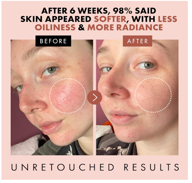 Lotion tonique à l'eau de rose Eclat Skincare – Lotion tonique hydratante pour le visage – Eau de rose à l'acide hyaluronique et à l'aloe vera – Formule sans alcool et apaisante pour la peau – Soin du visage rajeunissant et calmant